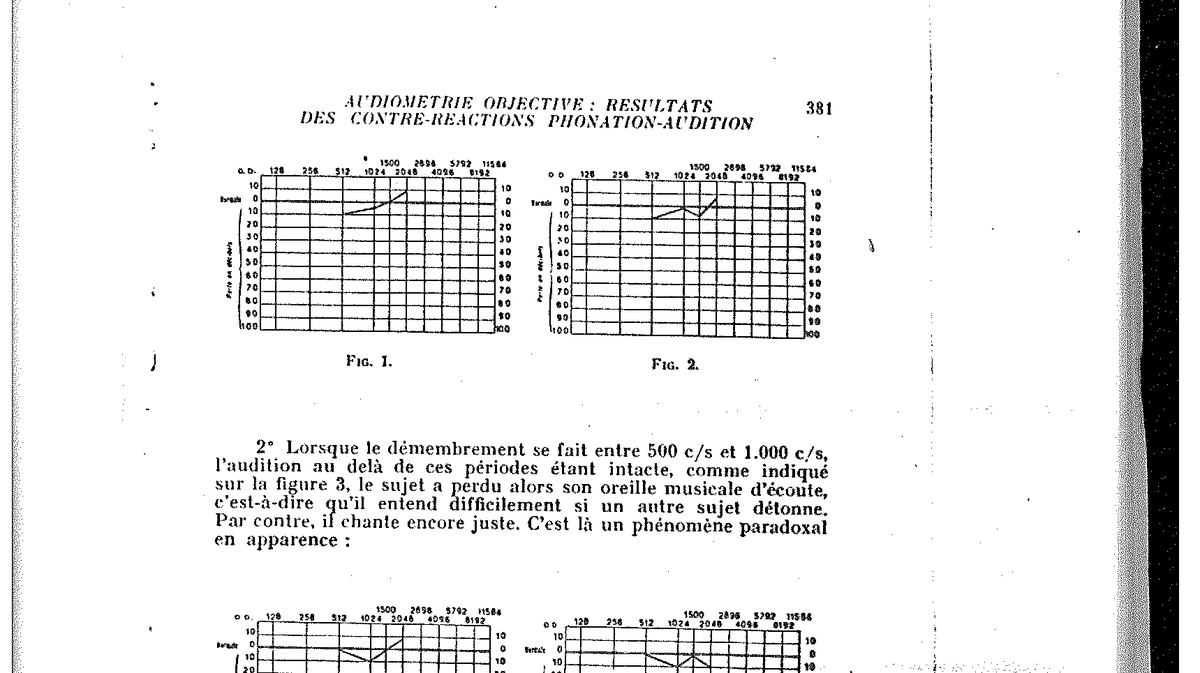 Abb. 1 und Abb. 2 — Referenzaudiogramme: regelmäßiger Anstieg von 500 bis 2 00